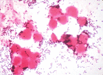    Staphylococcus aureus
